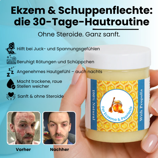 GlacierGlow Skin – Pflegender Balsam für trockene, gereizte Haut